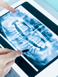 Digitales Röntgen Tablet Röntgenbild