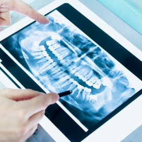 Digitales Röntgen Tablet Röntgenbild