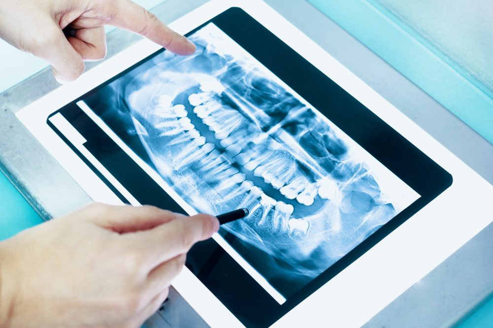 Digitales Röntgen Tablet Röntgenbild