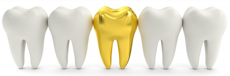 Zahnersatz goldener Zahn